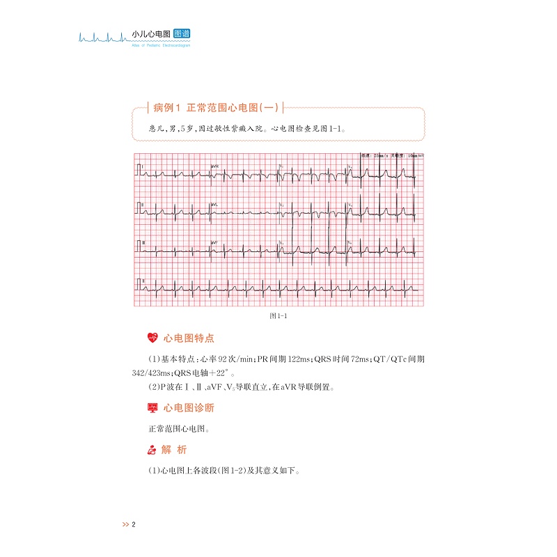 试读PDF-9787308269995(1-1)-小儿心电图图谱_016.jpg