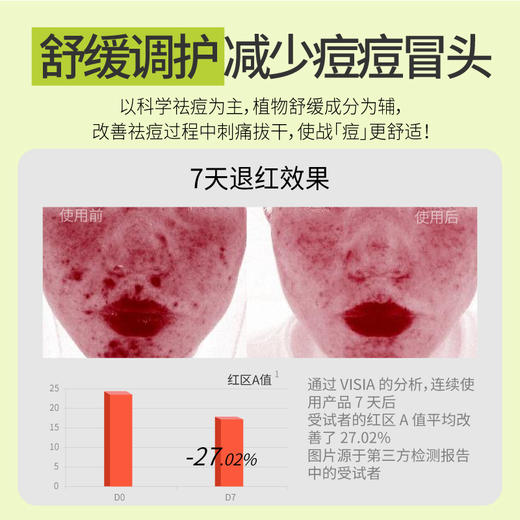 UKU控油无酸祛痘清透修复精华液30ml/ 商品图2