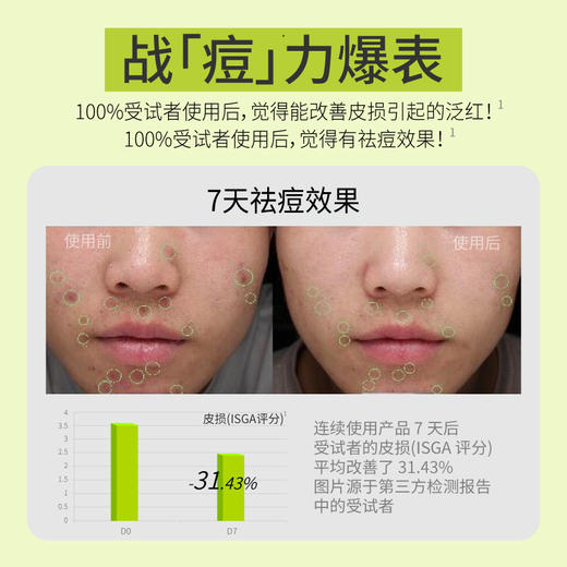 UKU控油无酸祛痘清透修复精华液30ml/ 商品图1