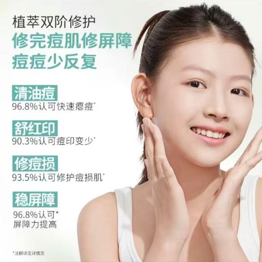 袋鼠妈妈青少年安肌沁润霜祛痘面霜修护改善舒缓泛红控油50g 商品图9