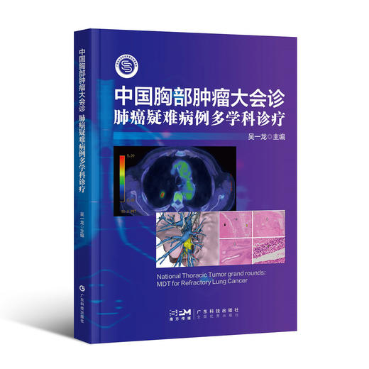 中国胸部肿瘤大会诊——肺癌疑难病例多学科诊疗（龙哥查房3 主编：吴一龙） 商品图0
