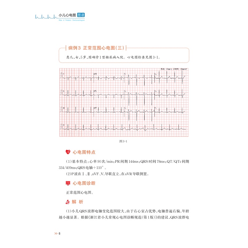 试读PDF-9787308269995(1-1)-小儿心电图图谱_020.jpg