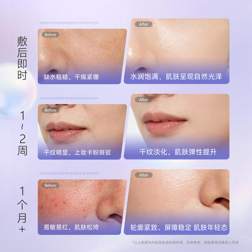 【🔥新品尝鲜】39度花间小语玻色因双抗紧致面膜10片/盒 再送3片花语面膜 抗皱补水保湿淡化细纹焕亮肤色 商品图7