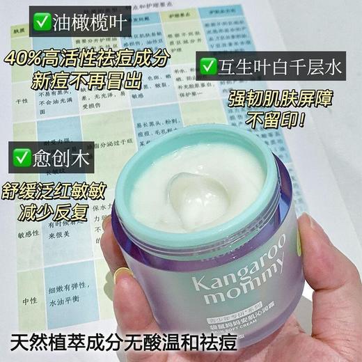 袋鼠妈妈青少年安肌沁润霜祛痘面霜修护改善舒缓泛红控油50g 商品图6