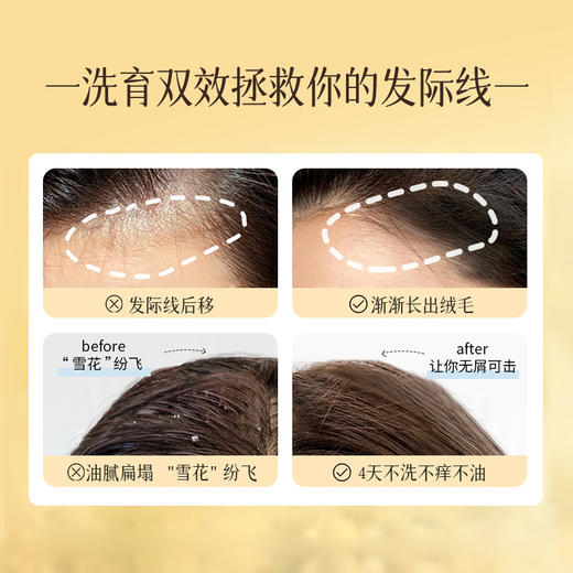 【🔥99选3件+送洗护𝟏𝟑件】  生姜洗发水500ml 滋养发根护发控油蓬松去屑止痒洗头露旗舰店正品|儒意官方旗舰店 商品图3