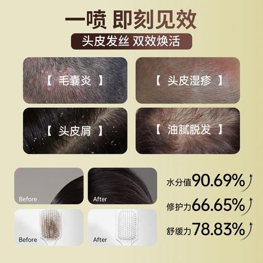 ²149元/2瓶【重组胶蛋白头皮修护喷雾】30ml/瓶 HM02-CRMM-CFBNH 商品图2