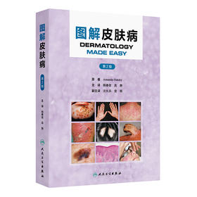 图解皮肤病（第2版）