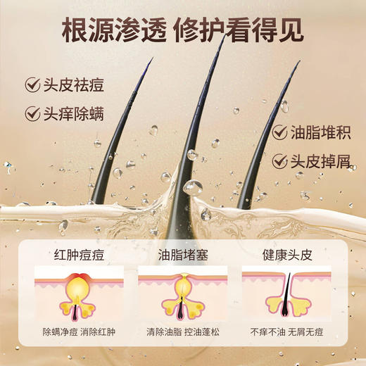 ²149元/2瓶【重组胶蛋白头皮修护喷雾】30ml/瓶 HM02-CRMM-CFBNH 商品图5