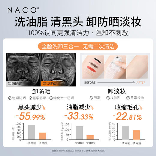 【微信会员专享福利】#NACO烟酰胺祛痘淡印套组 （烟酰胺次抛30支+层孔菌祛痘次抛60支+氨基酸洗面奶100g） 商品图8