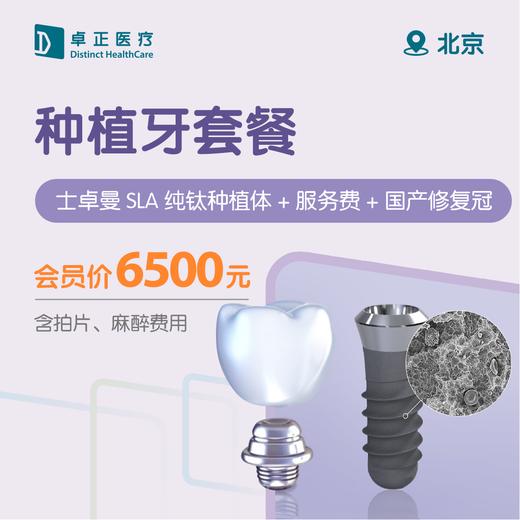 北京种植牙套餐（士卓曼SLA种植体/颗+服务费+国产修复冠） 商品图0