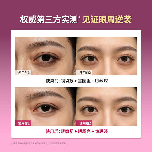 【可程专属】轻龄堂灵芝千日菊眼部紧致抗皱臻粹油10ml /10ml *2【佳人严选】 商品图4