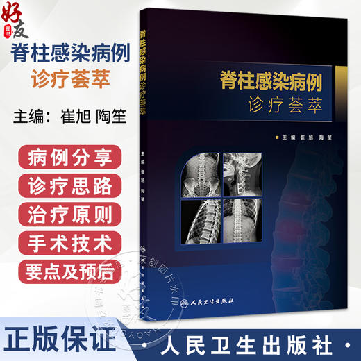 脊柱感染病例诊疗荟萃 崔旭 陶笙 主编 详细阐述脊柱结核误诊行椎体强化术患者的治疗原则和方法 9787117390040 人民卫生出版社 商品图0