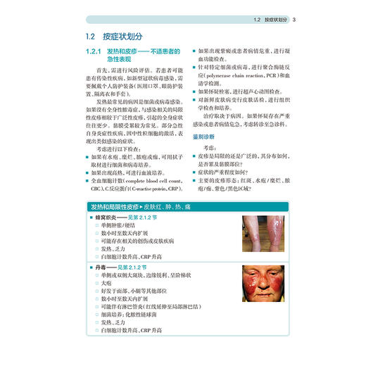 图解皮肤病 第2二版 杨春俊 高静 主译 本专著可以用来帮助快速诊断皮肤疾病或状况 皮肤病学与性病学9787117388528人民卫生出版社 商品图4
