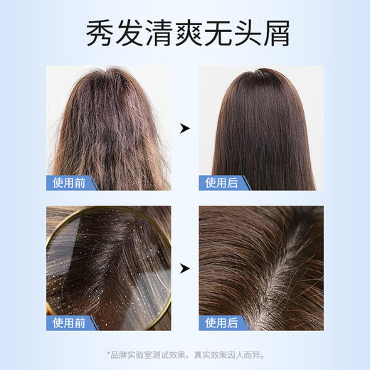 【ACM】净透洗发水 商品图3