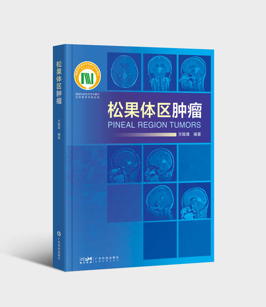 松果体区肿瘤 商品图0