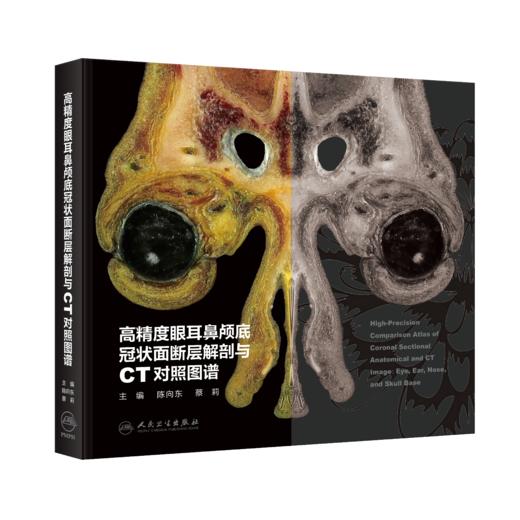 高精度眼耳鼻颅底冠状面断层解剖与CT对照图谱 商品图0
