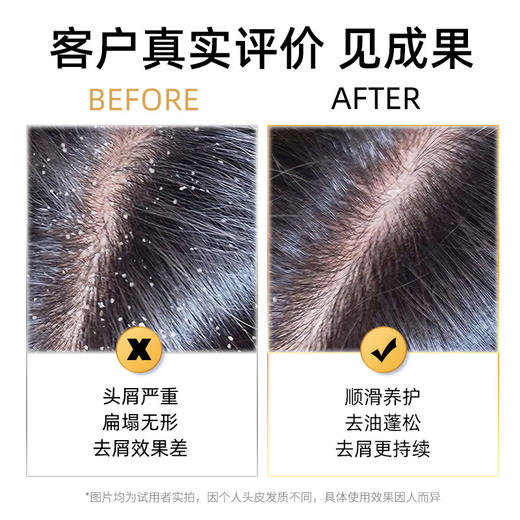 同康采乐 山茶花去屑止痒洗发水 第6代全新升级 27年老国货品牌 自研CLT靶向去屑技术 200ml/瓶 商品图7