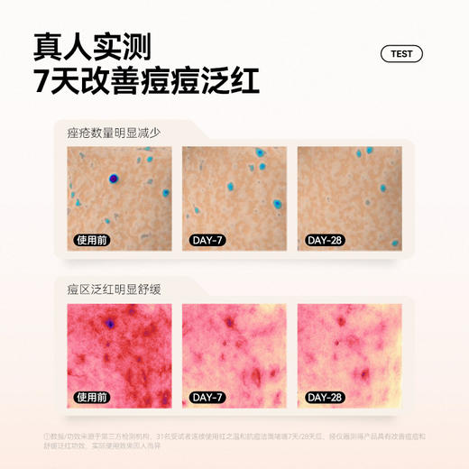 【折扣特价 | 任选3件享6折】温和抗痘洁面啫喱100g+同款15g 商品图2
