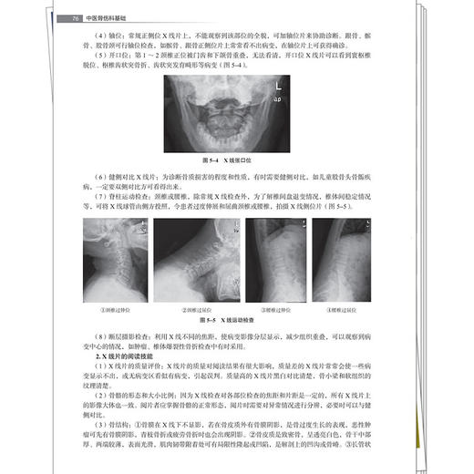 中医骨伤科基础 全国高等职业教育新形态规划教材 周锦颢 汤群珍 供针灸推拿中医养生保健中西医结临床等专业使用中国中医药出版社 商品图4