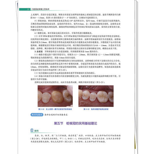 口腔固定修复工艺技术 全国高等职业教育新形态规划教材 刘绍良 供口腔医学口腔医学技术口腔卫生保健等专业使用中国中医药出版社 商品图4