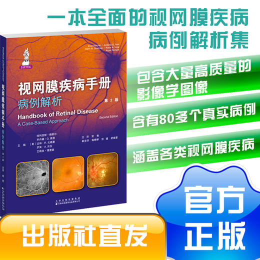 视网膜疾病手册：病例解析（第2版） 商品图0