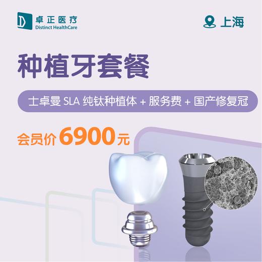 上海种植牙套餐（士卓曼SLA种植体/颗+服务费+国产修复冠） 商品图0