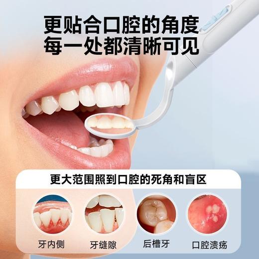 在家检查口腔问题 家用口腔内窥镜子 手电筒防雾高清镜片学生看牙齿检查 商品图4