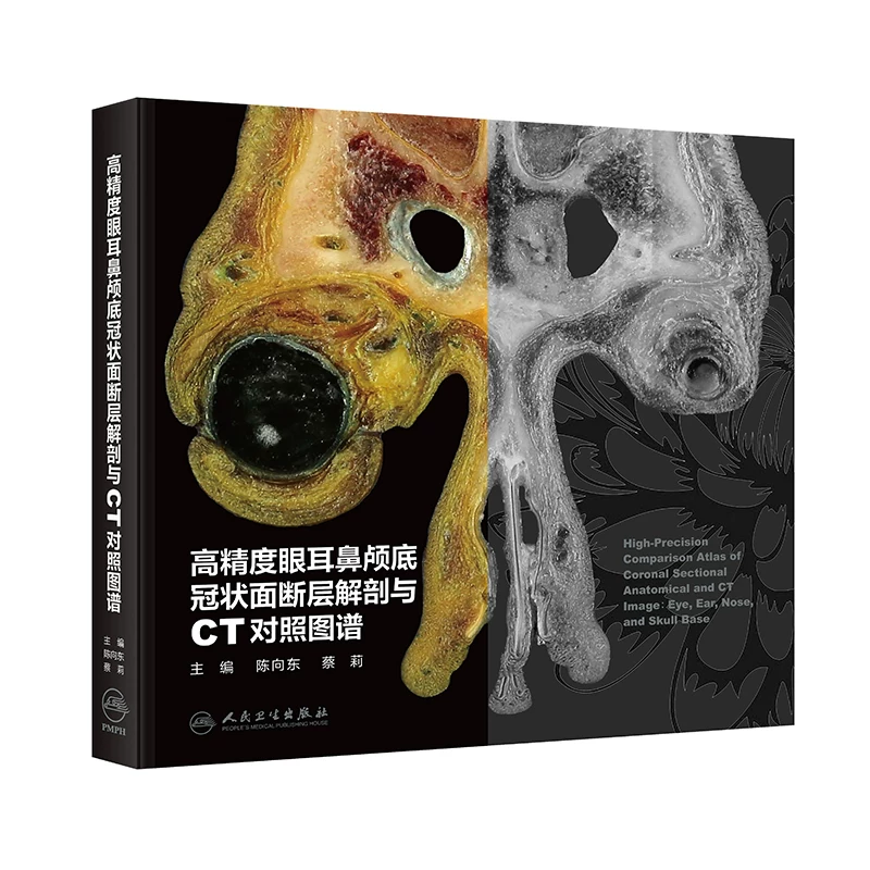 高精度眼耳鼻颅底冠状面断层解剖与CT对照图谱  主编 陈向东 蔡莉  人卫出版