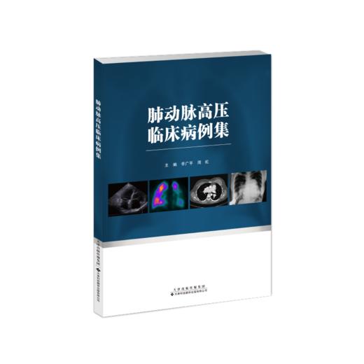 肺动脉高压临床病例集 商品图0