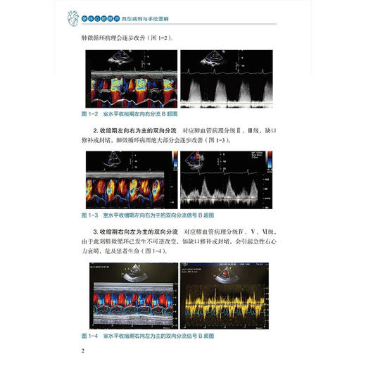 临床心脏超声典型病例与手绘图解 李叶阔 费洪文 章春泉 主编 超声科医师技师心胸外科临床医生9787559145659辽宁科学技术出版社 商品图4