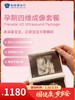 孕期四维成像套餐｜囤健康，岁岁安 1.22-2.23 商品缩略图0