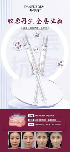 DANFEIPOEM重组三型胶原蛋白复合液(水光针)