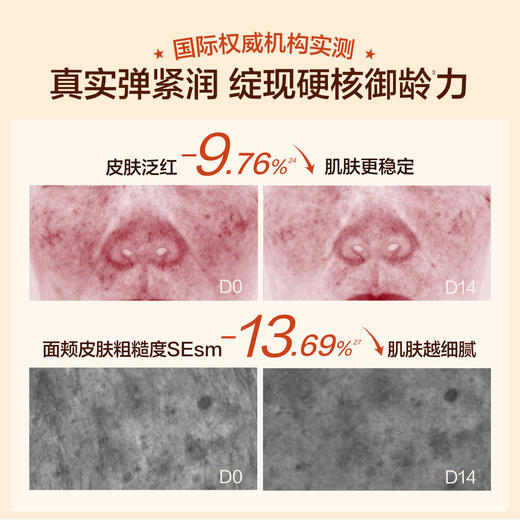 【限时买1送1】HBN弹簧水乳套装（蛋白水100ml+蛋白乳80ml） 商品图2