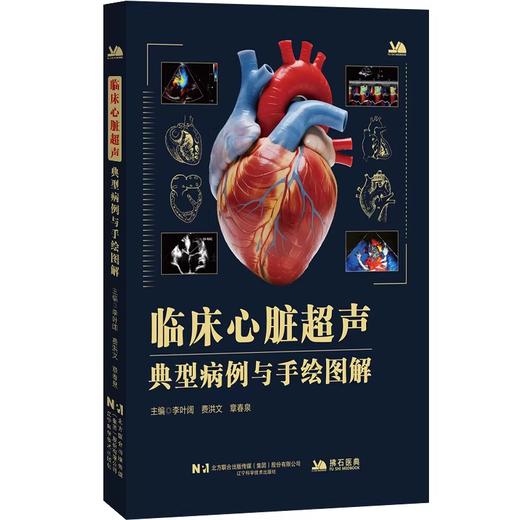 临床心脏超声典型病例与手绘图解 商品图0