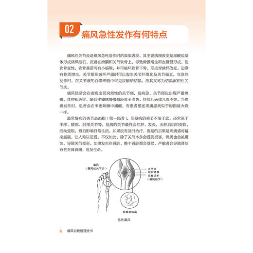 痛风自我管理全书（健康自我管理系列）田文正 主编 本书可作为痛风患者家庭治疗和自我管理的常备用书 中国医药科技出版社 商品图4