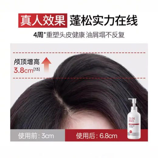 舒蕾 PRO紧致头皮控油去屑洗发露430g 商品图7