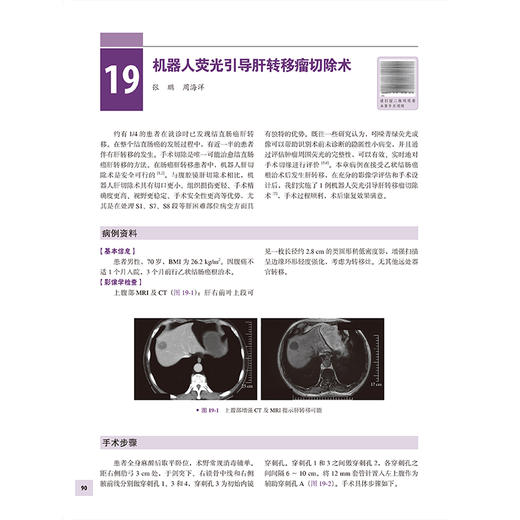 结直肠手术创新与优化实践 内含43段手术视频 周海洋 主编 全面介绍结直肠外科领域新技术 全盆腔脏器切除术等 北京大学医学出版社 商品图4