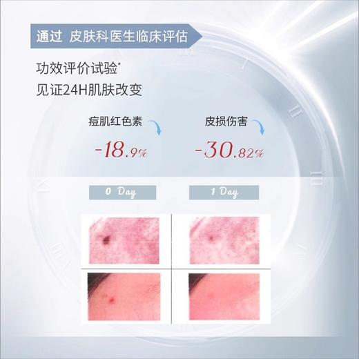 晓平牛蒡籽祛痘膏【2026新春好品】 商品图2