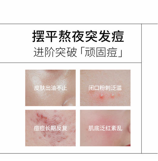 【江苏银行内购】绽媄娅祛痘控油次抛精华液温和战痘不反复 商品图3