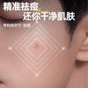 🔥【59元任选2件】左颜右色祛痘乳100g 精准消痘印 清爽不闷肤 商品缩略图3