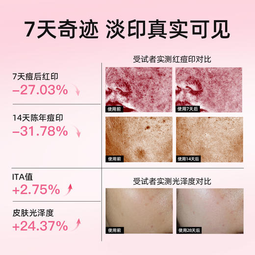 比度克匀净透光点涂精华修护泛红淡化痘后红印 商品图2