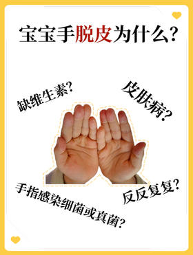 宝宝小手“蜕皮”莫惊慌，分清原因对症处理