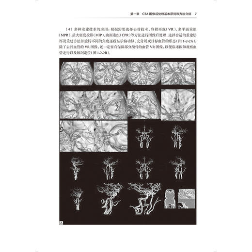 放射影像实践技能操作 住院医师规范化培训结业临床实践能力考核标准方案解读丛书 郑传胜 曹代荣 供放射影像专业用人民卫生出版社 商品图4