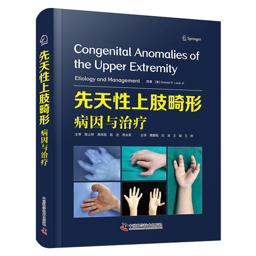 先天性上肢畸形：病因与治疗 商品图1