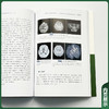北京协和医院 神经科住院医师病例报告汇编（2023-2024）朱以诚 主编 涵盖神经急重症、疑难罕见病等 中国协和医科大学出版社 商品缩略图4