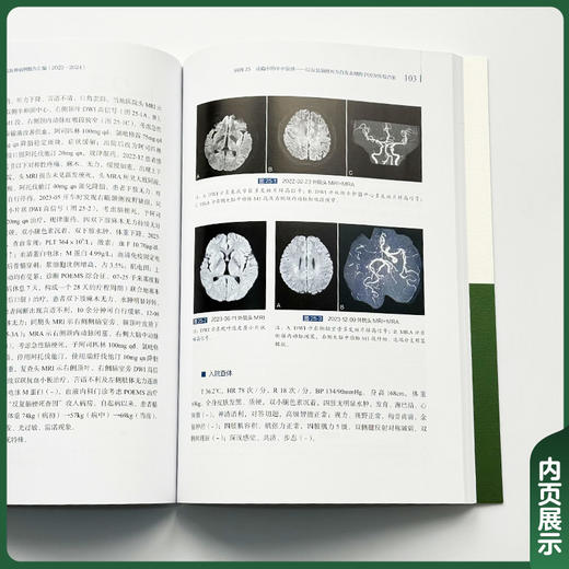 北京协和医院 神经科住院医师病例报告汇编（2023-2024）朱以诚 主编 涵盖神经急重症、疑难罕见病等 中国协和医科大学出版社 商品图4