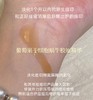高端高浓配置葡萄果蜗牛胶原精华液淡化1个月内急性痘印红斑期外力挤压的痘痕痘印修护屏障抗火抗氧20g 商品缩略图1