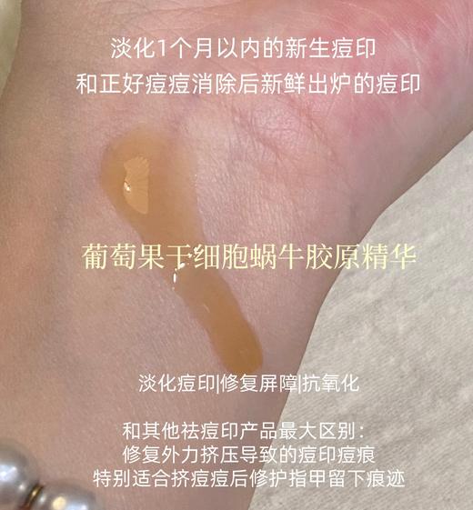 高端高浓配置葡萄果蜗牛胶原精华液淡化1个月内急性痘印红斑期外力挤压的痘痕痘印修护屏障抗火抗氧20g 商品图1