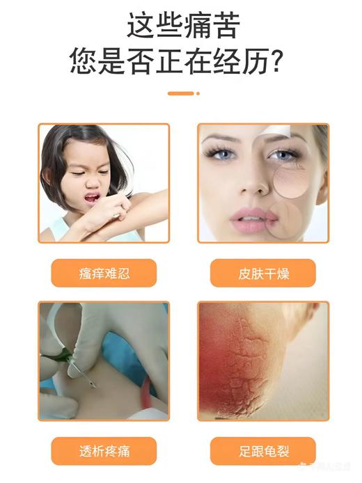 透稀仁-肝素钠护瘘凝胶（原2号精油升级专利版）40克/只（晚上用-舒缓） 商品图2