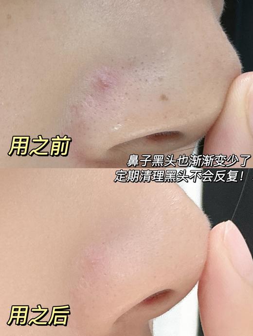 【到手两瓶】润熙泉清洁泥膜浅釉净澈泥膜110g/瓶 保质期：【2026年11月】 商品图4